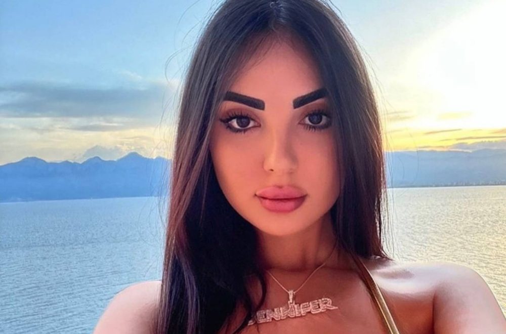Se operó los glúteos múltiples veces para verse como Kim Kardashian: ahora no puede caminar