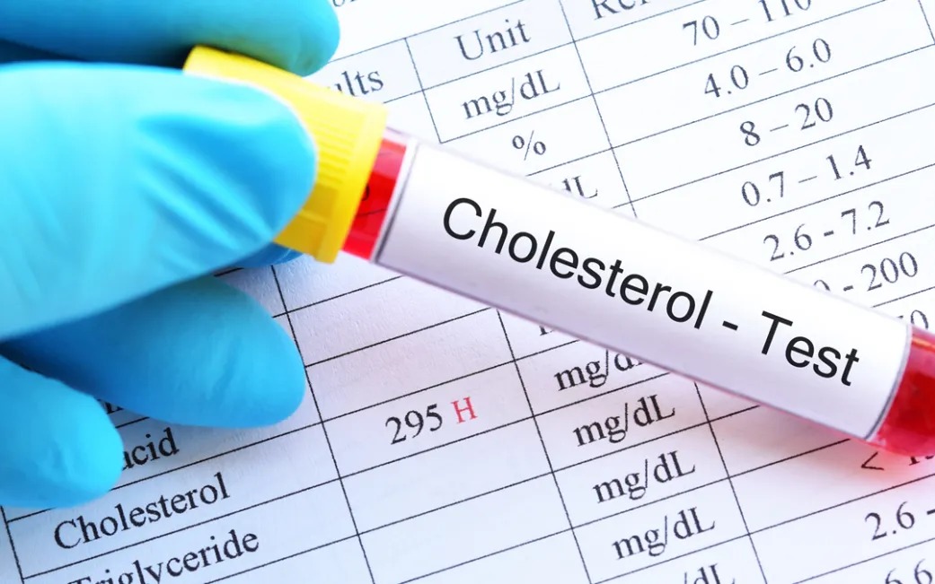 Por primera vez editan el genoma de una persona para reducir el colesterol alto