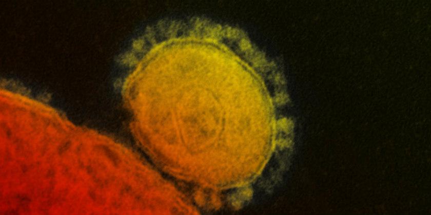 Esto es todo lo que debe saber sobre el coronavirus, un virus que se ha extendido en EEUU