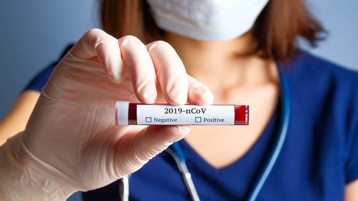UniVista: ¿Mi seguro de vida me cubre del coronavirus?