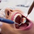 ¿HMO o PPO, que plan dental escojo?