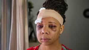 Mujer agredida por un policía habla ante el Congreso