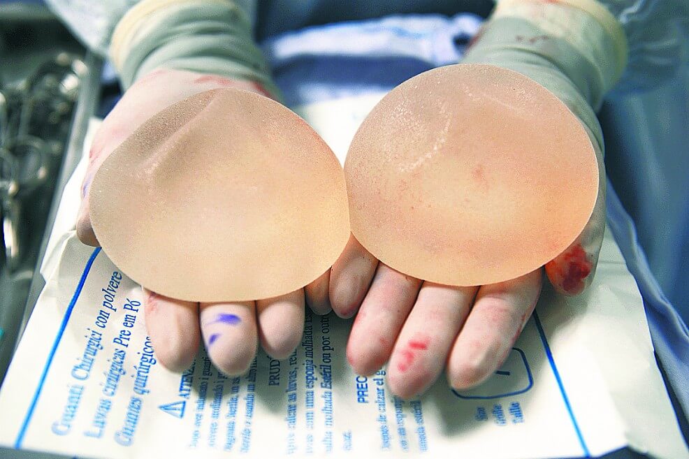 Retiran del mercado una marca de implantes mamarios vinculados con un raro tipo de cáncer