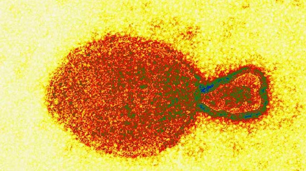Nuevo virus de origen animal en China ya tiene más de 35 afectados
