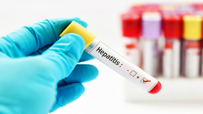 Los CDC investigan más de 100 casos de hepatitis inexplicable en niños
