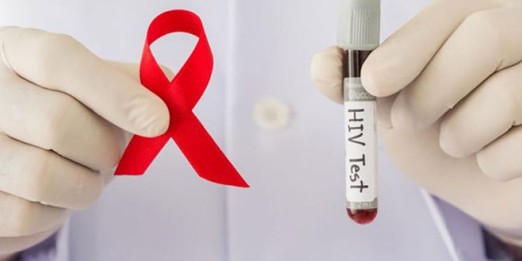 Detects a variant of HIV that deteriorates the immune system faster