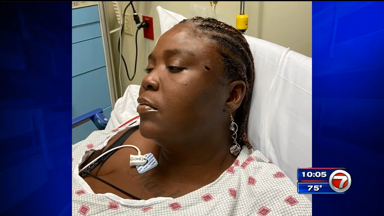 Médicos encuentran una bala en la cabeza de una mujer días después del tiroteo en Miami-Dade