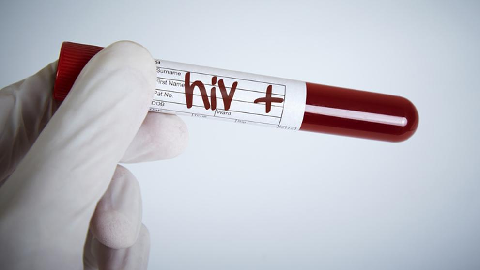 Confirman el segundo caso de curación del VIH en el mundo
