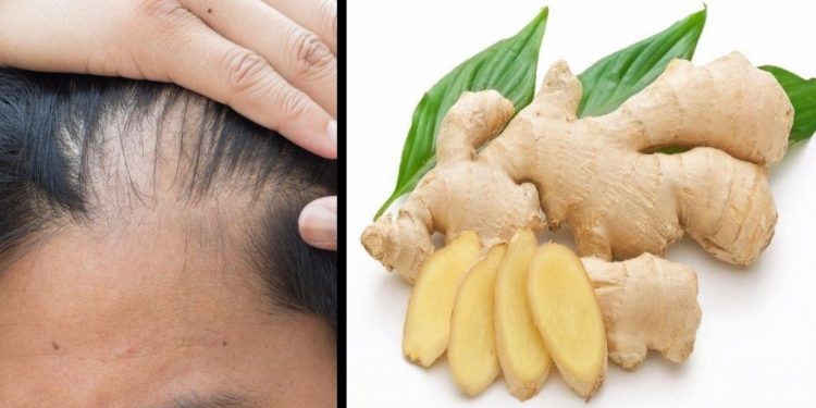 The secret of ginger: find out the of this root and stop hair loss