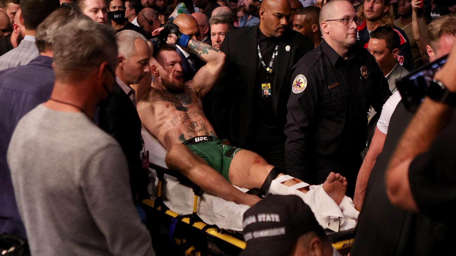 Conor McGregor duró más de tres horas en cirugía tras la horrible lesión