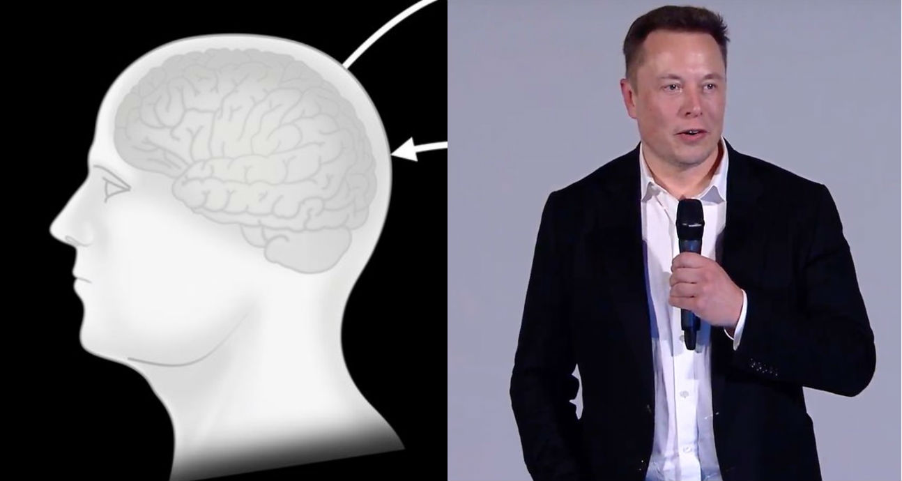 Elon Musk mostrará los avances de Neuralink… ¡en una demostración en tiempo real !