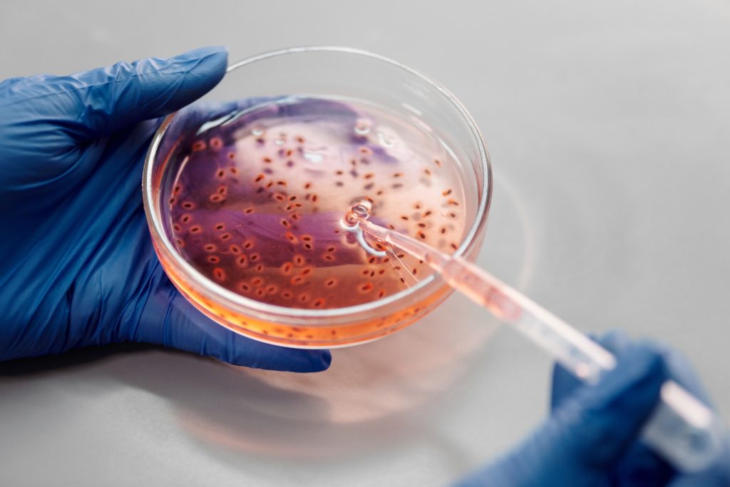 bacteria