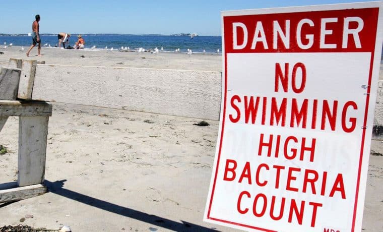 Departamento de Salud alerta sobre contaminación en playa de Miami Beach