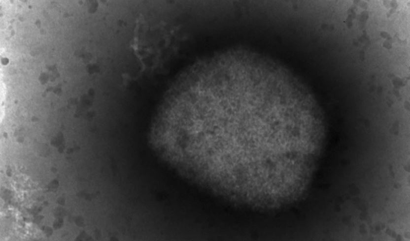 ¡Atención! CDC detecta 2 cepas de viruela del mono en EEUU